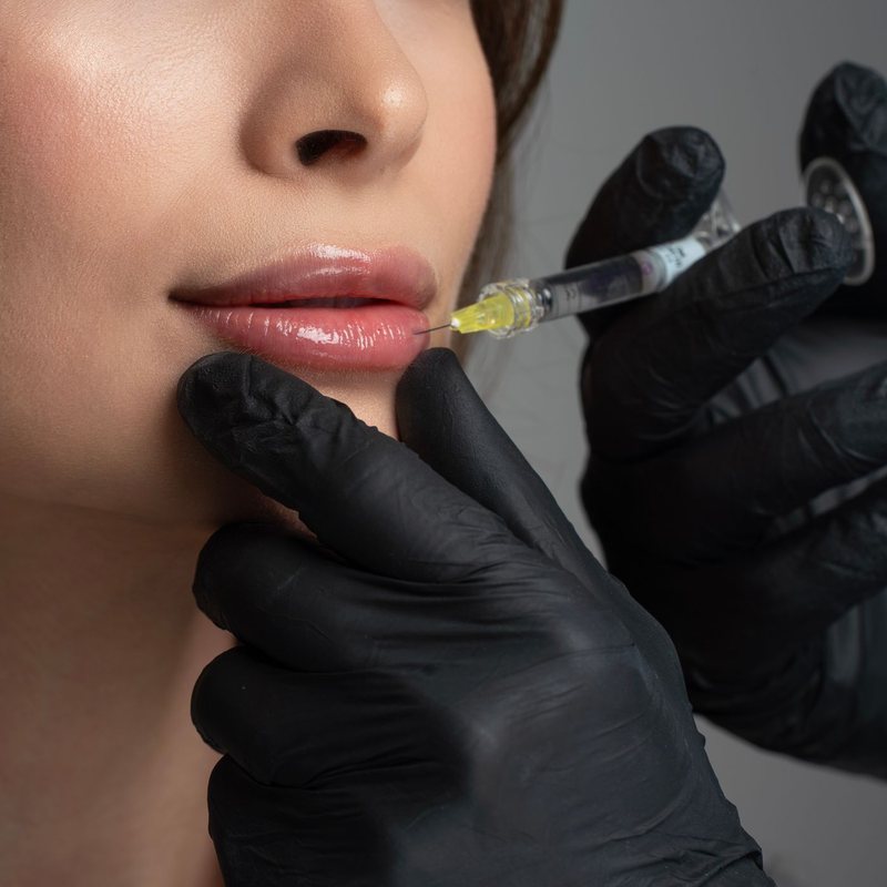 A practitioner performing a precise facial injection