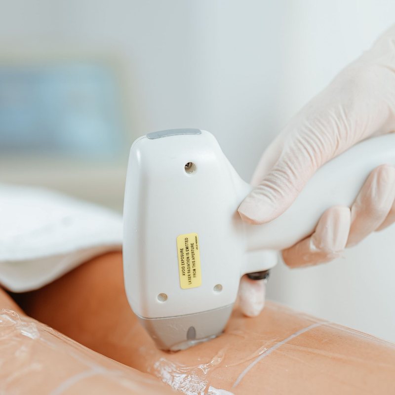 A medical laser handpiece treating the skin