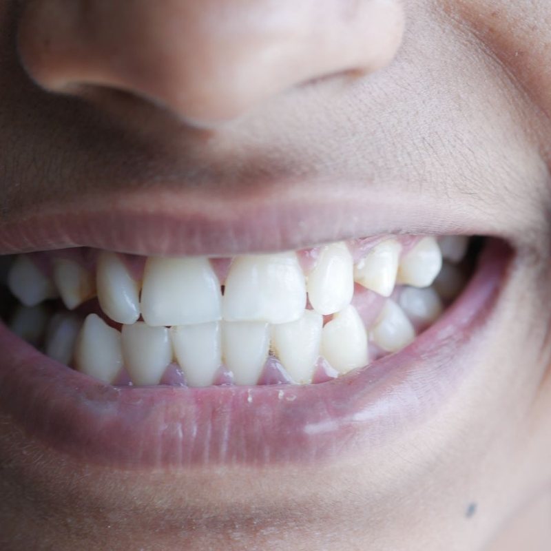Close-up of a bright, even smile